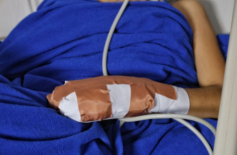 El Tolima sumó 4 nuevos casos de personas quemadas con pólvora en la Noche de Velitas